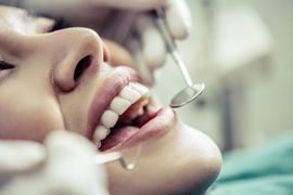 Tecnicas-e-Materiais-de-Restauracao-Dental
