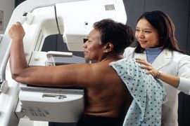 Metodos-de-Exames-de-Mamografia-e-Densitometria-Ossea