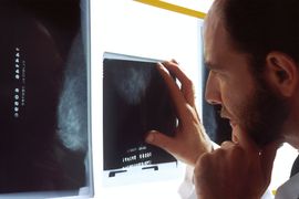 Metodos-de-Formacao-da-Imagem-Radiologica