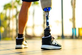 disabled-athlete-man-with-prosthetic-walking-at-th-2023-11-27-05-31-53-utc--1-