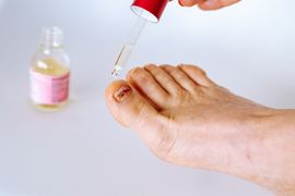 applying-oil-with-pipette-to-damaged-toe-nail-2024-04-19-18-20-16-utc--1-