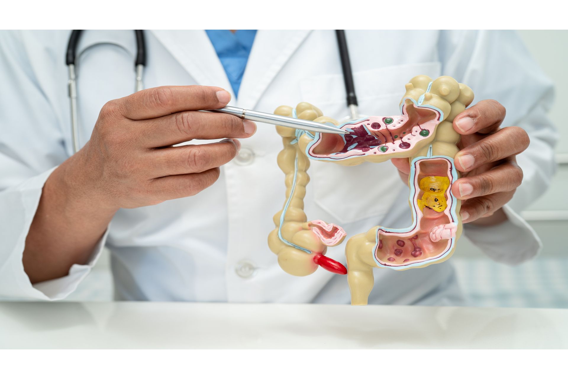 intestine-appendix-and-digestive-system-doctor-h-2024-04-17-18-58-47-utc--1-