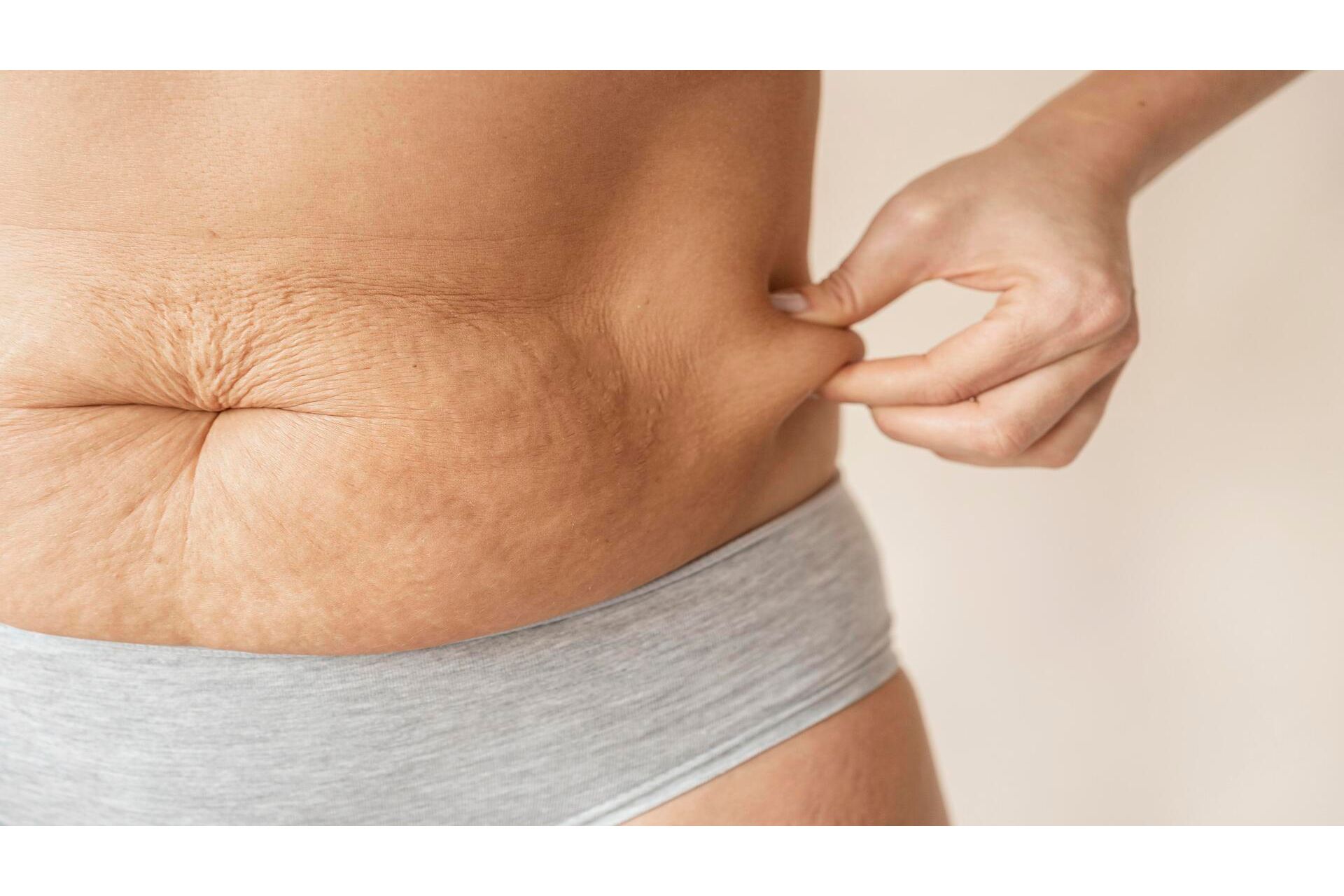 Protocolo de Avaliação de Fibro Edema Gelóide e Facial