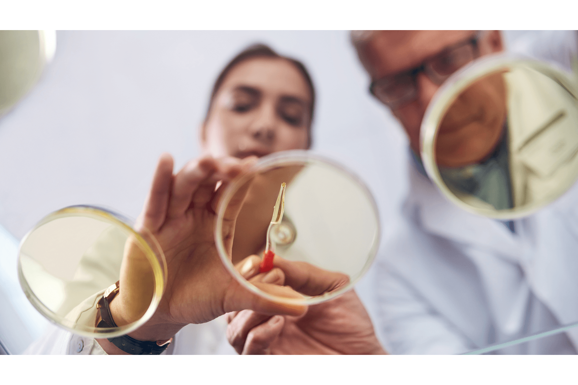 Himenolepíase: Diagnóstico, Tratamento e Prevenção