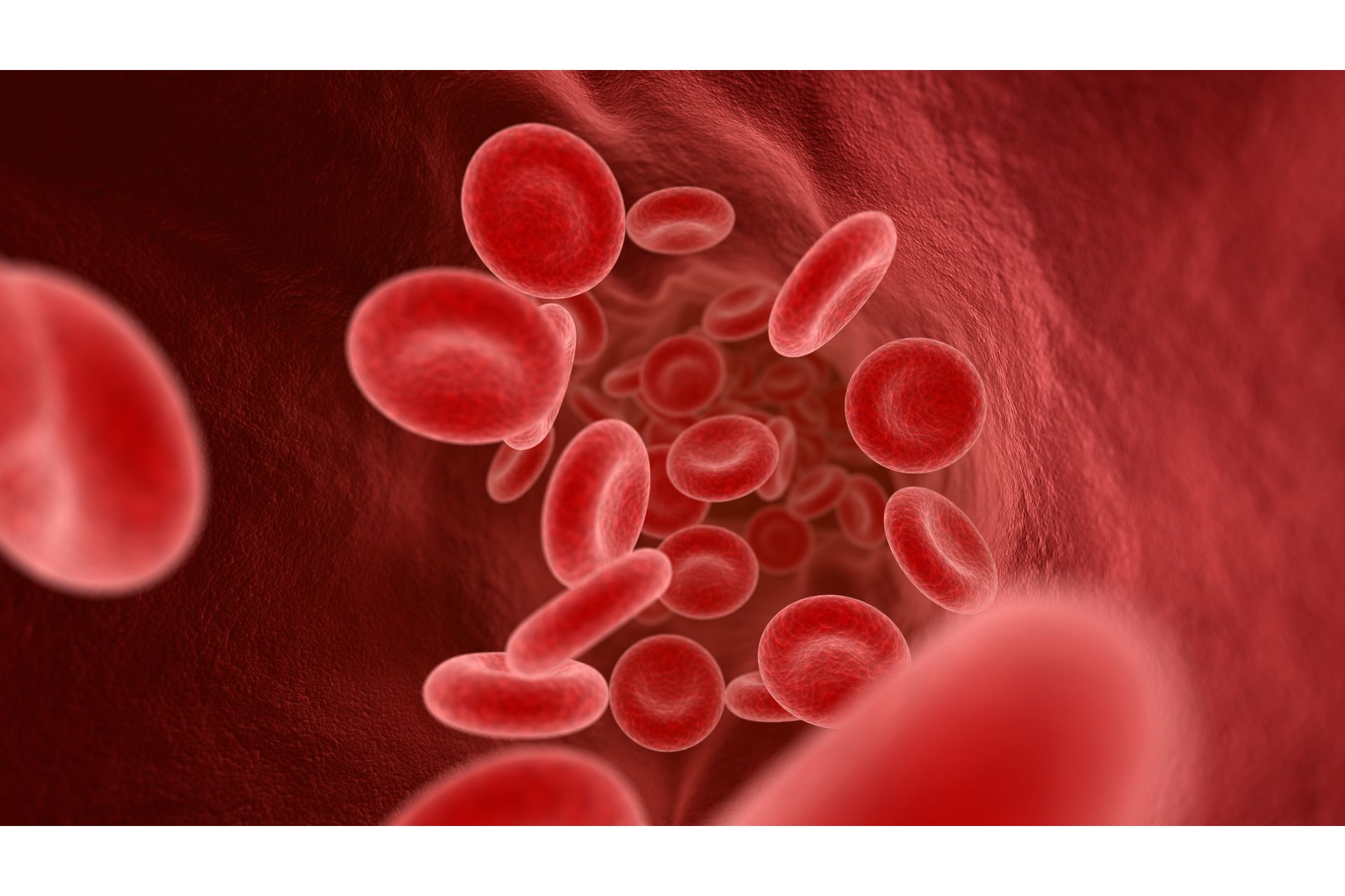 Aterosclerose e Neoplasias: Fatores Clínicos e Causas