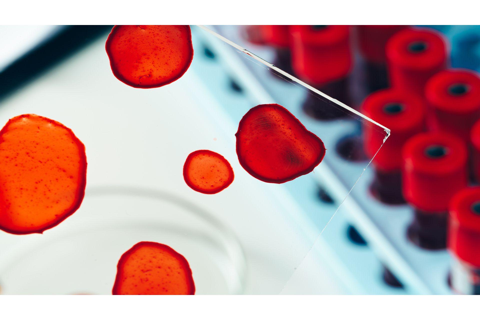 Hematologia: Análise de Amostras e Células-Tronco