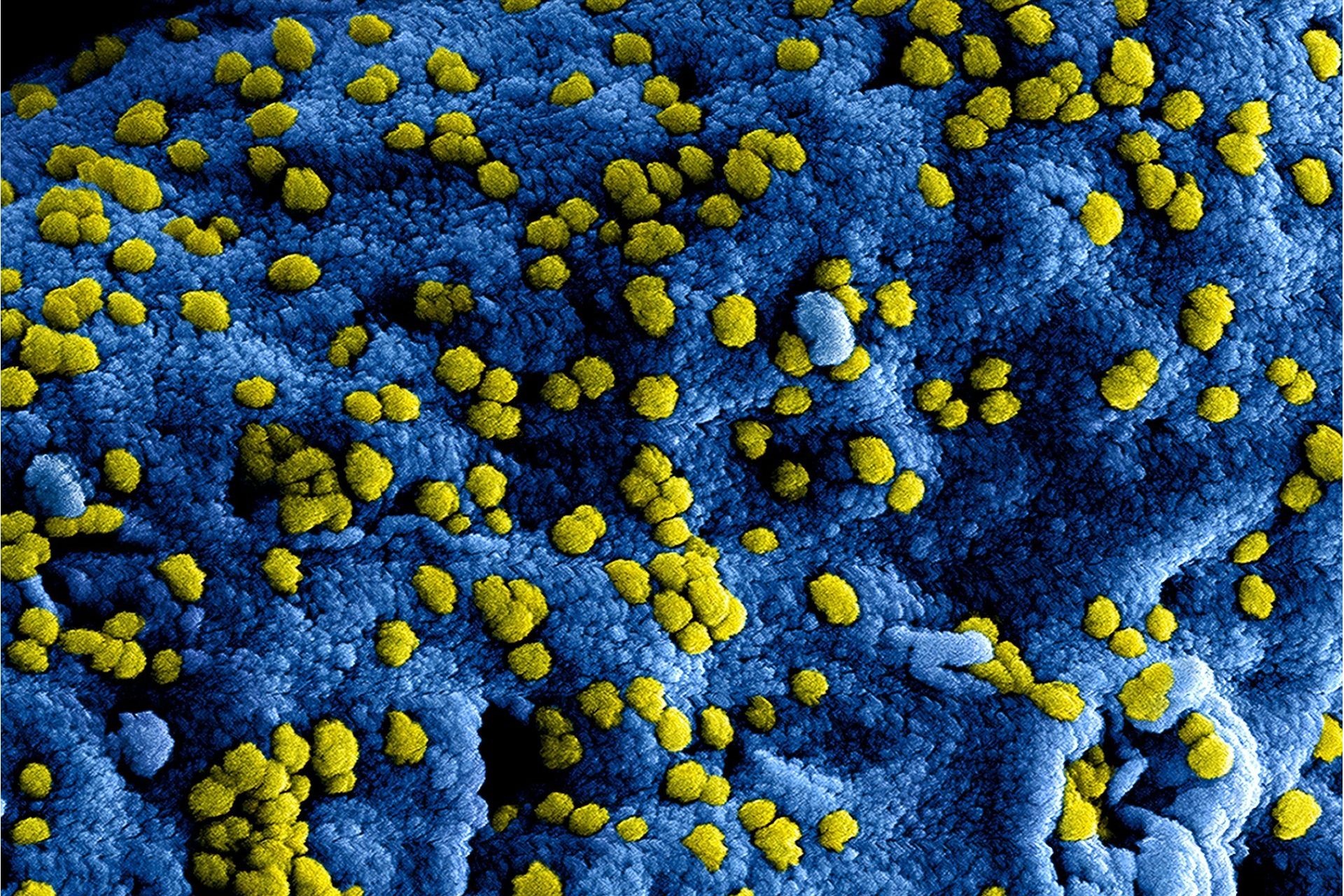 Tipos de Infecções de Enterobactérias e no SNC