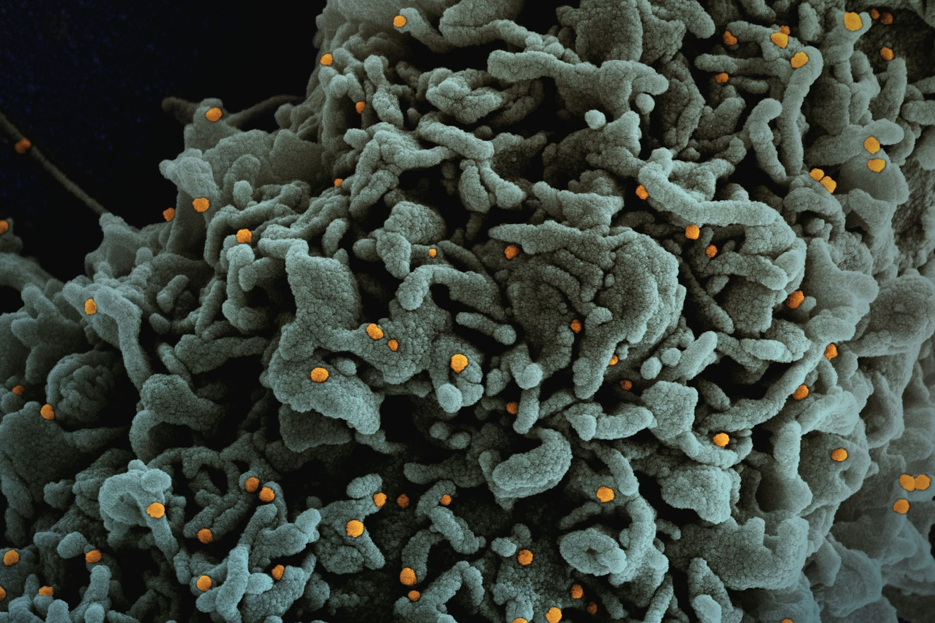 Biomedicina: Epigenética e Surgimento do Câncer