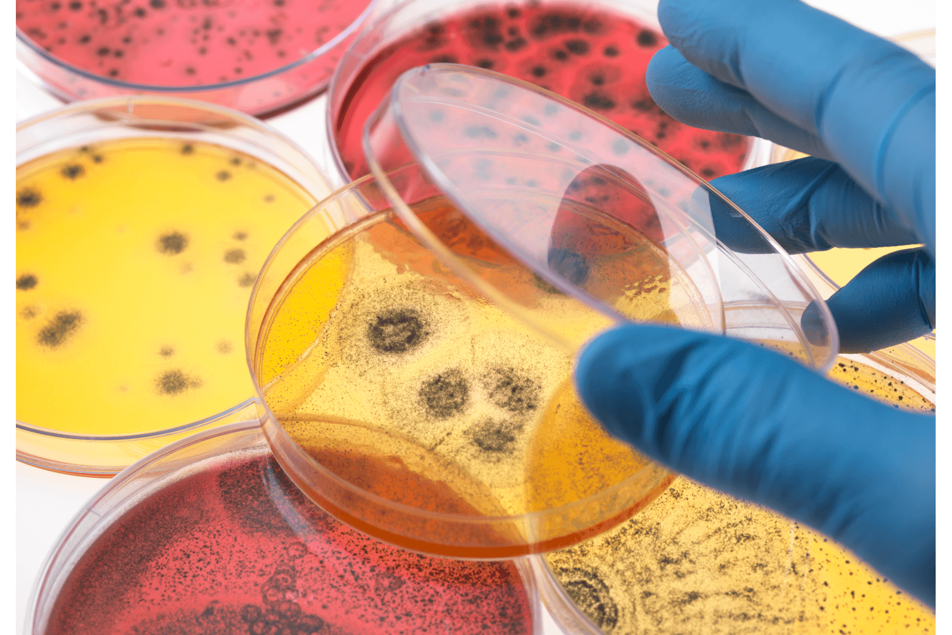 Doenças Bacteriológicas Resistentes a Antibióticos