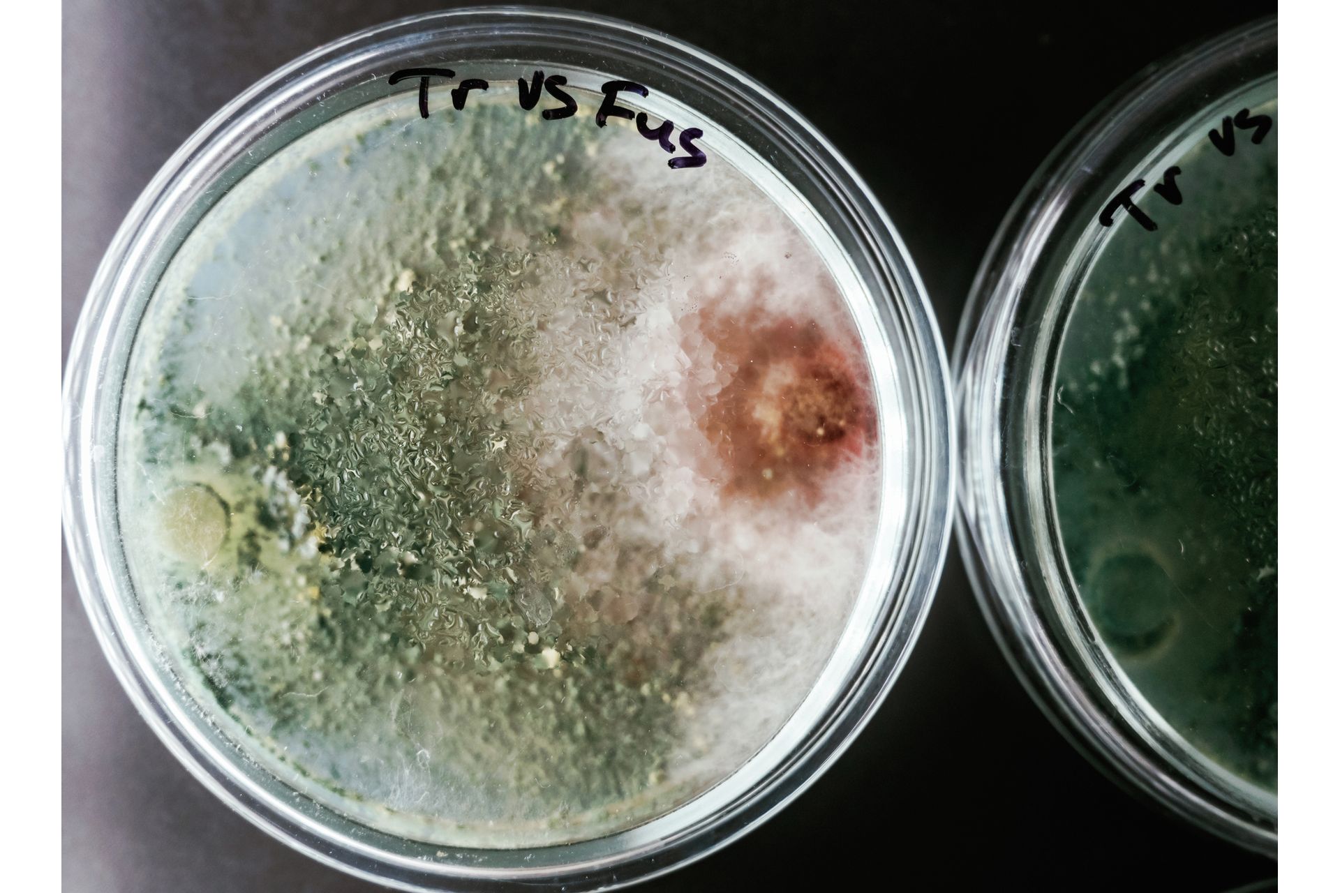 Diagnóstico Laboratorial de Fungos e Leveduras